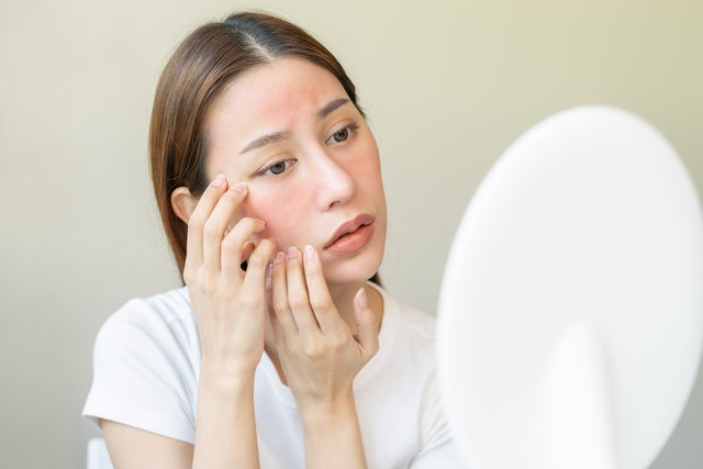 Difficult acne? Hormonal treatment might help